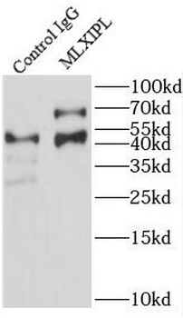 MLXIPL Rabbit Polyclonal Antibody