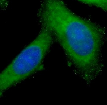 MMP12 Rabbit Polyclonal Antibody