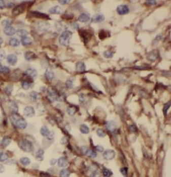 MMP12 Rabbit Polyclonal Antibody
