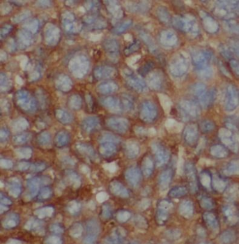 MMP20 Rabbit Polyclonal Antibody