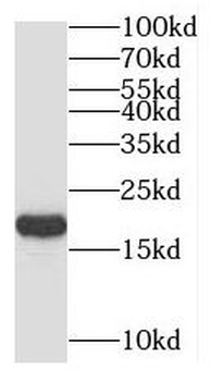 UBE2V2 Rabbit Polyclonal Antibody