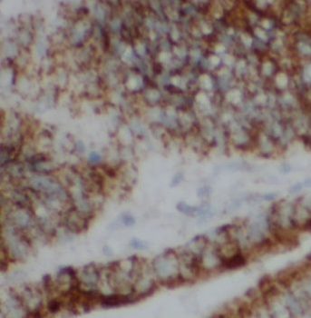 UBE2V2 Rabbit Polyclonal Antibody