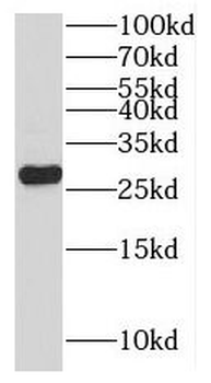 MOB1B Rabbit Polyclonal Antibody