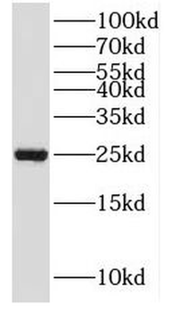 MOB3A Rabbit Polyclonal Antibody