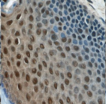 MORF4L1 Rabbit Polyclonal Antibody