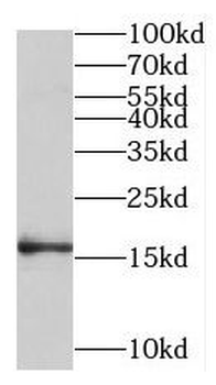 MPZL1 Rabbit Polyclonal Antibody