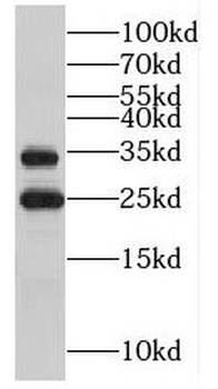 MPZL2 Rabbit Polyclonal Antibody