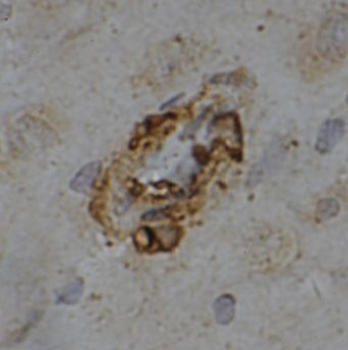 MRAP2 Rabbit Polyclonal Antibody