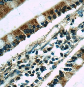 ABCC2 Rabbit Polyclonal Antibody