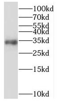 MRPL15 Rabbit Polyclonal Antibody