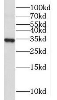 MRPL19 Rabbit Polyclonal Antibody
