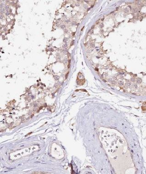 MRPL19 Rabbit Polyclonal Antibody