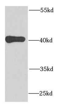 MRPS22 Rabbit Polyclonal Antibody