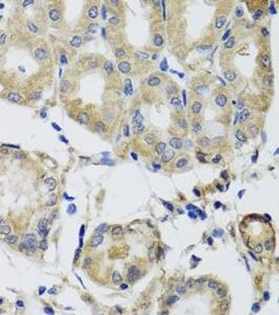 MRPS22 Rabbit Polyclonal Antibody