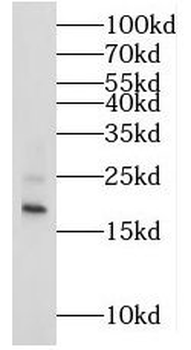 MRPS25 Rabbit Polyclonal Antibody