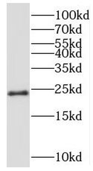 MRPS26 Rabbit Polyclonal Antibody
