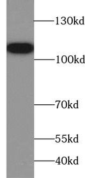MSH2 Rabbit Polyclonal Antibody