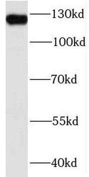MSH3 Rabbit Polyclonal Antibody