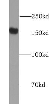 MSH6 Rabbit Polyclonal Antibody
