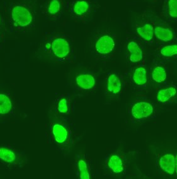 MSH6 Rabbit Polyclonal Antibody