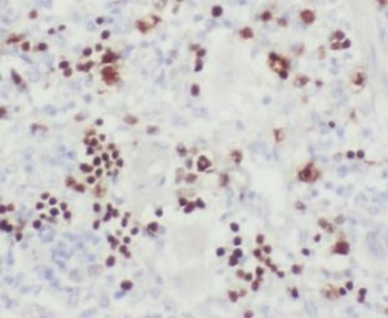 MSH6 Rabbit Polyclonal Antibody