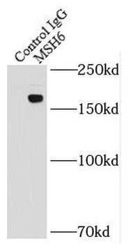 MSH6 Mouse Monoclonal Antibody