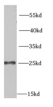 MSRA Rabbit Polyclonal Antibody