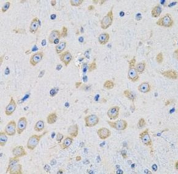 MSRA Rabbit Polyclonal Antibody