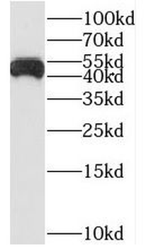 STK26 Rabbit Polyclonal Antibody