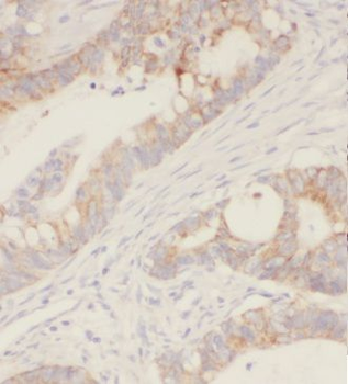 STK26 Rabbit Polyclonal Antibody