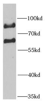 MTA3 Rabbit Polyclonal Antibody