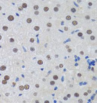 MTA3 Rabbit Polyclonal Antibody