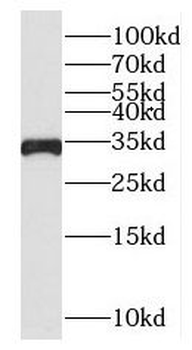 MTCH2 Rabbit Polyclonal Antibody