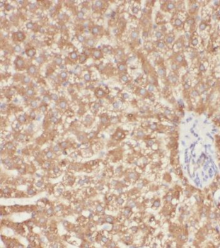 MTCH2 Rabbit Polyclonal Antibody