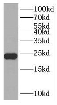 NUDT1 Rabbit Polyclonal Antibody