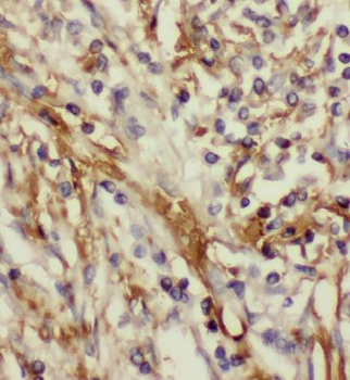 NUDT1 Rabbit Polyclonal Antibody