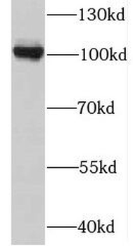 MTHFD1 Rabbit Polyclonal Antibody