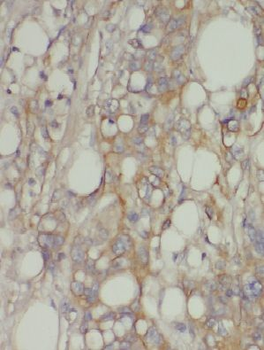 MTHFD1 Rabbit Polyclonal Antibody