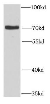 MTMR14 Rabbit Polyclonal Antibody