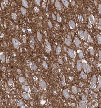 MTMR14 Rabbit Polyclonal Antibody