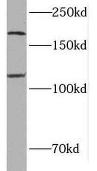 MTUS1 Rabbit Polyclonal Antibody