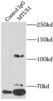 MTUS1 Rabbit Polyclonal Antibody