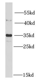 MTX1 Rabbit Polyclonal Antibody