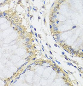 MTX1 Rabbit Polyclonal Antibody