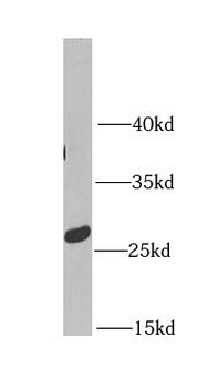 MTX2 Rabbit Polyclonal Antibody