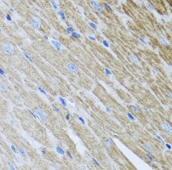 MTX2 Rabbit Polyclonal Antibody
