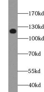 MUC1 Rabbit Polyclonal Antibody