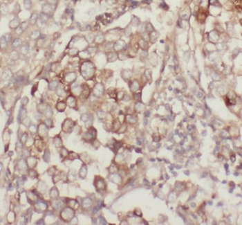 MUC1 Rabbit Polyclonal Antibody