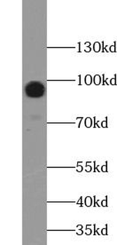 MUC16 Rabbit Polyclonal Antibody