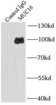 MUC16 Rabbit Polyclonal Antibody